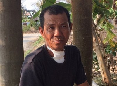 Nạn nhân Huỳnh Văn Hùng với vết thương khá nặng ở vùng cổ vẫn còn bàng hoàng sau vụ cướp (Ảnh: Công an nhân dân)