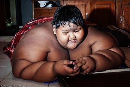 Cậu bé Arya Permana (10 tuổi) sống tại Tây Java (Indonesia) hiện được coi là cậu bé béo nhất thế giới. 