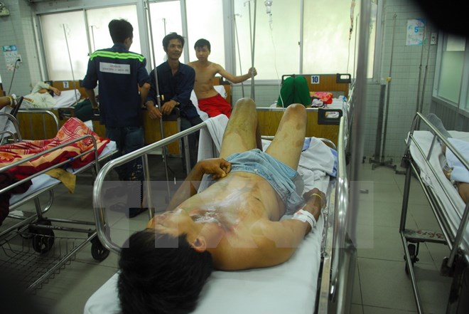 Anh Lương Văn Chí 42 tuổi, bị bỏng 60% đang được điều trị tại khoa cấp cứu, Bệnh viện Chợ Rẫy. (Ảnh: Mạnh Linh/TTXVN)