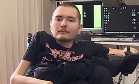 Bệnh nhân người Nga tình nguyện ghép đầu Valery Spiridonov.