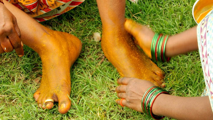 Chữa nứt chân. Trộn bột nghệ với dầu dừa. Bôi lên chân, để nguyên trong 30-45 phút rồi rửa sạch. Việc này sẽ cung cấp độ ẩm, chữa lành vết nứt chân.