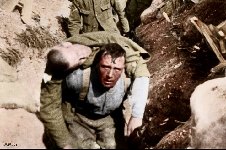 Cảnh trong bộ phim “Trận chiến Somme”: Một lính Anh chở một đồng đội bị thương quay về mặt trận.