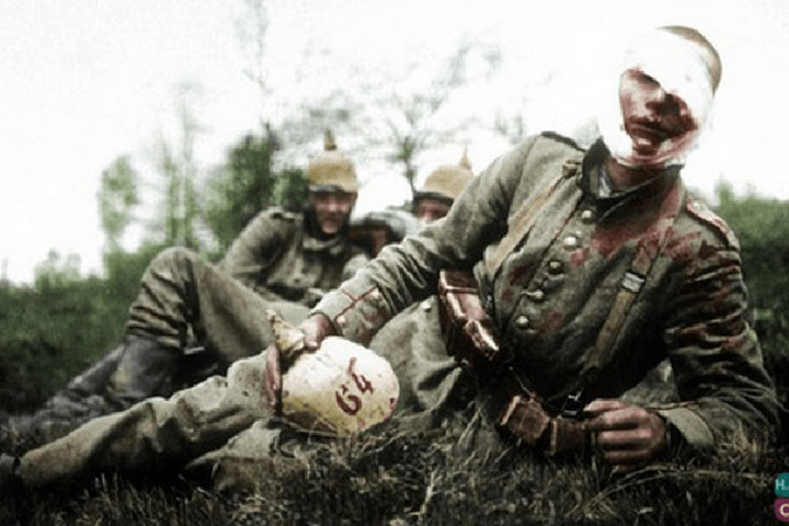 Một lính Đức bị thương. Người này có thể thuộc trung đoàn bộ binh 64 của Sư đoàn 6. Ảnh chụp tháng 5/1915.
