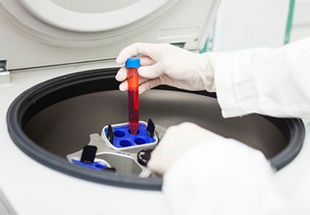 Mẫu máu bệnh nhân được đưa vào máy ly tâm để chiết tách các thành phần làm nên loại gel mới. Ảnh: manhattan-dermatology.com