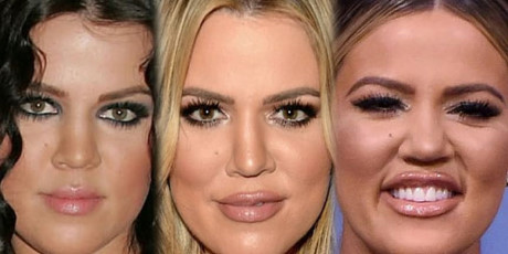 Khloe Kardashian vốn sở hữu một chiếc mũi tẹt, ngắn và thô nhưng trước đó, chưa bao giờ cô nghĩ đến việc sẽ phẫu thuật thẩm mỹ để cải thiện nhược điểm. Thay vào đó, em gái của Kim 