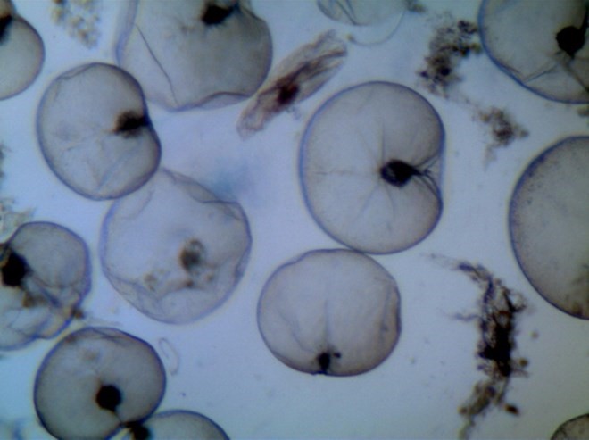 Loài Noctiluca scintillans soi dưới kính hiển vi khi phân tích mẫu nước biển. (Nguồn: Monre)
