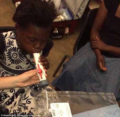 Một bé gái ở Malawi thổi hơi vào một chiếc túi để thu hơi thở. Mẫu hơi thở sẽ được gửi đến phòng thí nghiệm ĐH Washington để được thử nghiệm về các hợp chất bệnh sốt rét sử dụng kỹ thuật chẩn đoán mới.