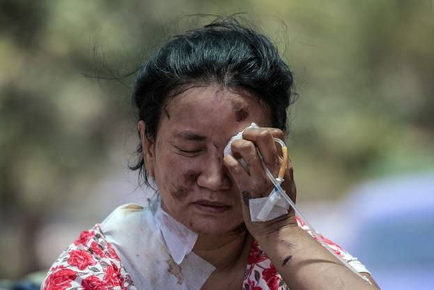  Một người phụ nữ bị thương giữ chặt một bên mắt khi đứng chờ bên ngoài một bệnh viện ở Palu ngày 3/10. Ảnh: Getty