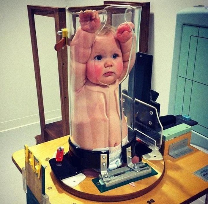 Đây là cách các bác sĩ chụp X-quang cho các em bé.