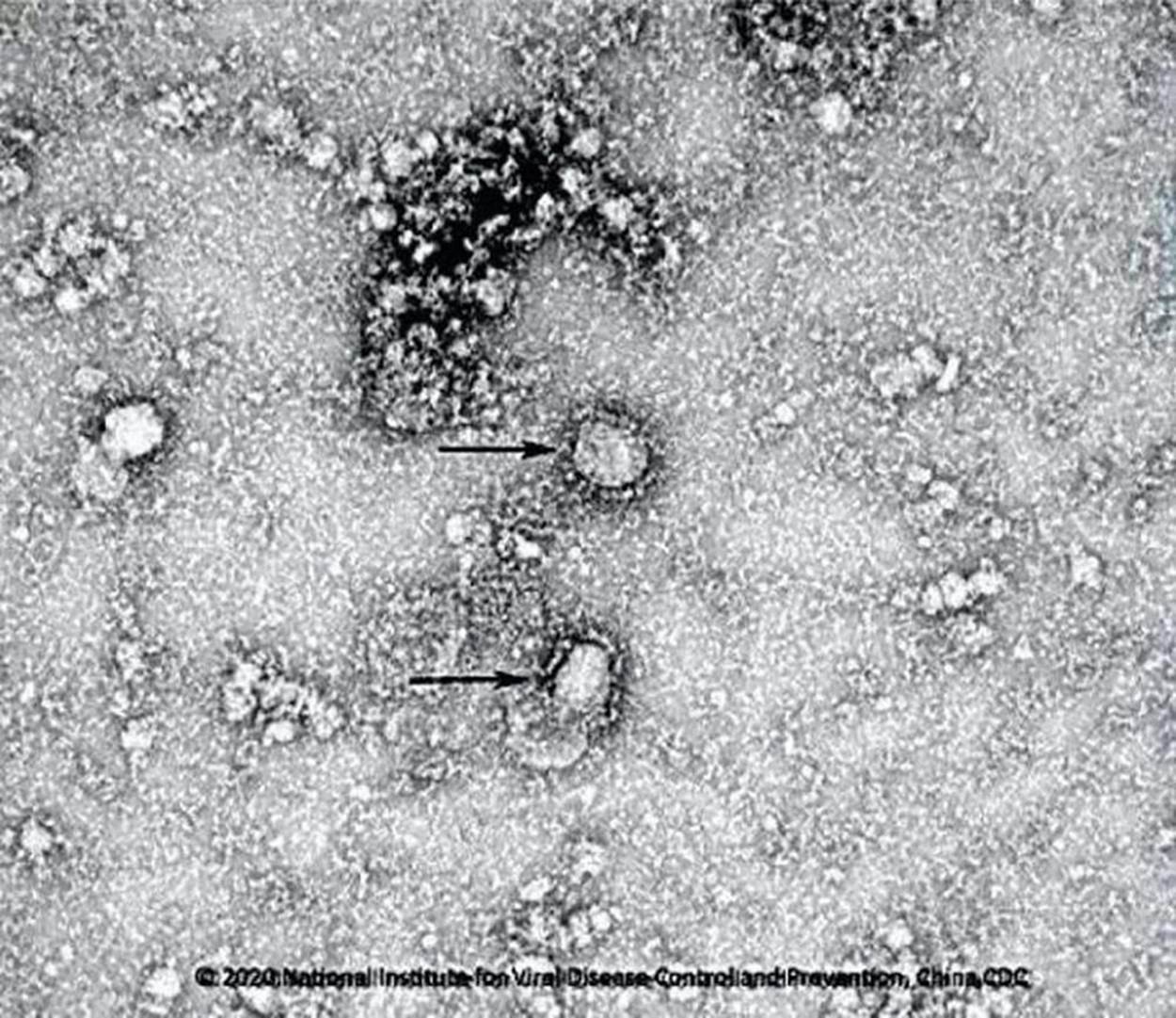   Hình ảnh đầu tiên của chủng virus Corona mới trên kính hiển vi. Ảnh: Reuters