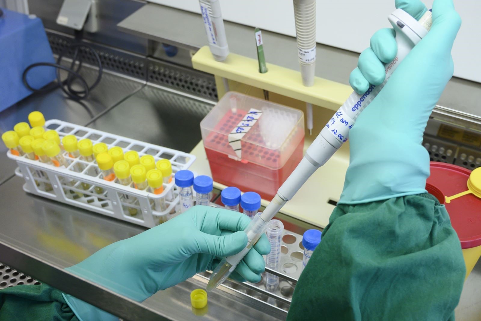 Nhân viên y tế xét nghiệm mẫu bệnh phẩm COVID-19 tại phòng thí nghiệm ở Stuttgart, miền Nam Đức ngày 2/3/2020. Ảnh: AFP/TTXVN