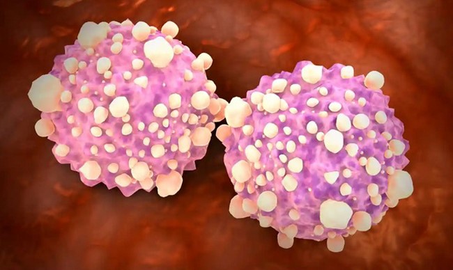 Tế bào ung thư tụy. Ảnh: Alamy Stock Photo
