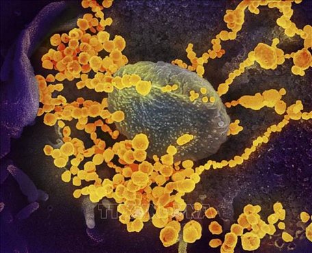 Hình ảnh virus SARS-CoV-2 (màu vàng) nổi lên bề mặt tế bào người. Ảnh: AFP/TTXVN