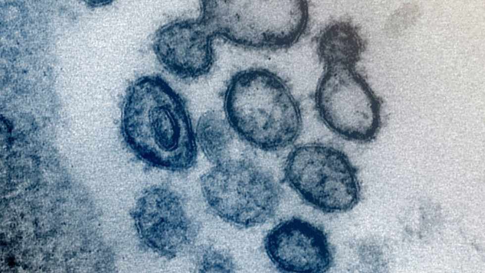 Hình ảnh virus SARS-CoV-2 được lấy từ cơ thể một bệnh nhân ở Mỹ. Ảnh: NIAID-RML