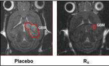 Hình ảnh cho thấy khối u não chuột nhỏ lại (bên phải) do được trị liệu bằng SHP2 Ảnh: MEDICAL XPRESS