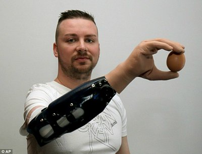 Bệnh nhân sử dụng cánh tay giả để cầm trứng.