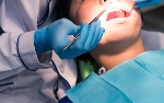 WHO: Gần một nửa dân số thế giới mắc bệnh răng miệng