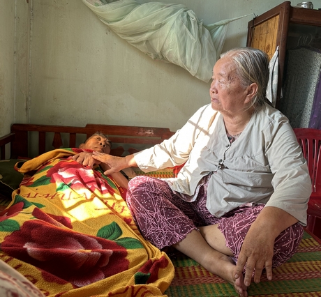 U ác bàng quang không tiền nhập viện