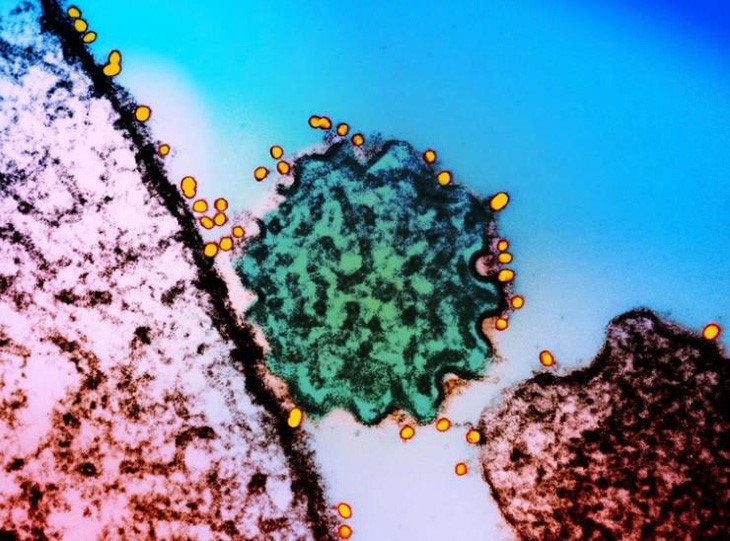 Hình ảnh vi rút Nipah (hạt màu xanh lục có cạnh hình vỏ sò) dưới kính hiển vi điện tử màu - Ảnh: National Institutes Of Health/Science