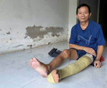 Neo đơn, gãy chân
không tiền chữa trị
