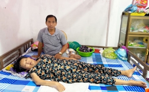 Di chứng nhồi máu não, gần 10 năm nằm một chỗ