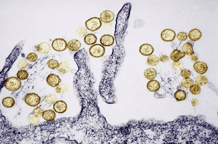 Dịch bệnh bùng phát trên tàu xuyên Đại Tây Dương: Sự nguy hiểm của virus Hanta