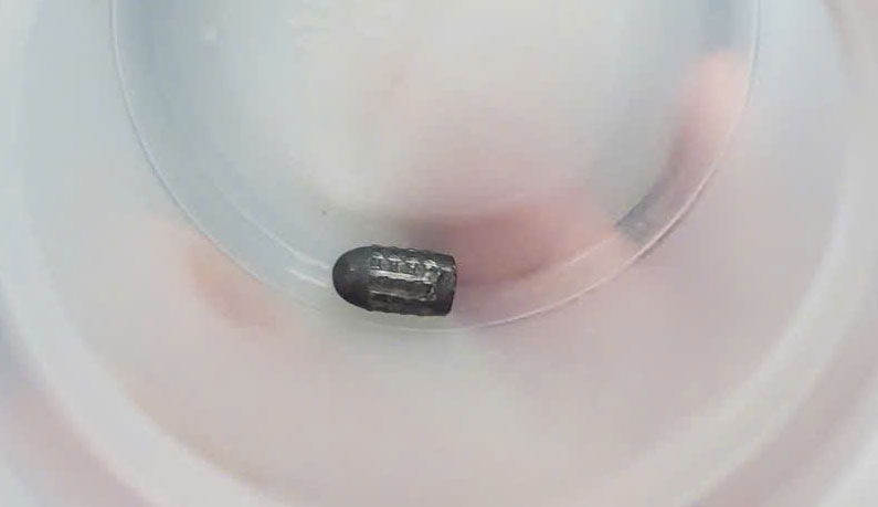 Dị vật kim khí hình đầu đạn 0,5x 0,3cm lấy ra từ vùng đầu bệnh nhân T.  