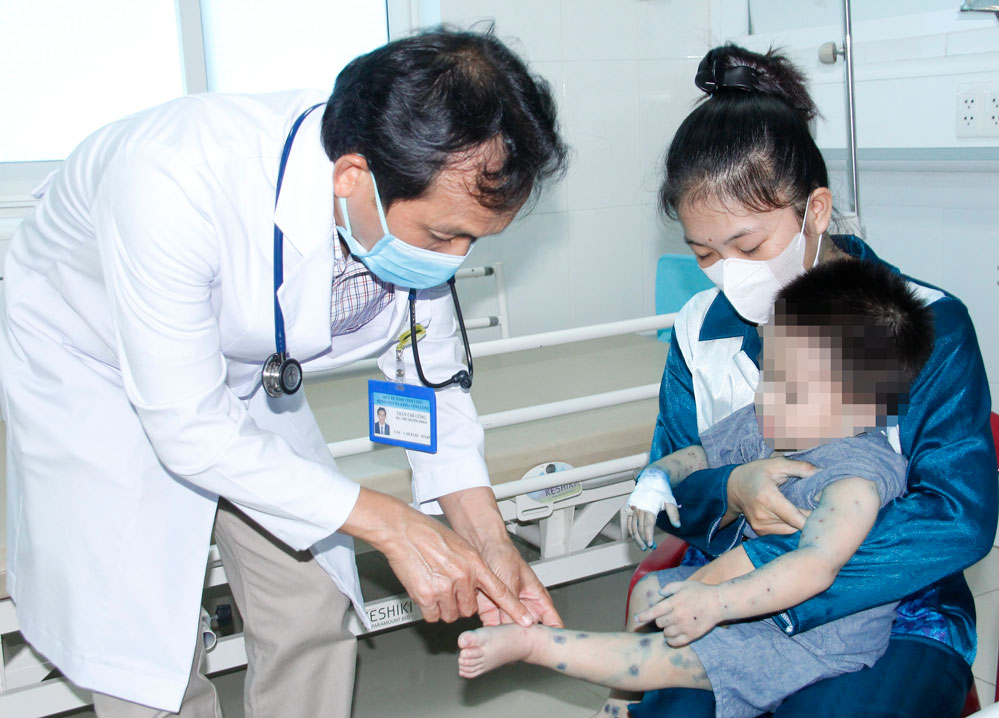 Trẻ mắc tay chân miệng nặng điều trị tại phòng bệnh nặng Khoa Nhi BVĐK Vĩnh Long.