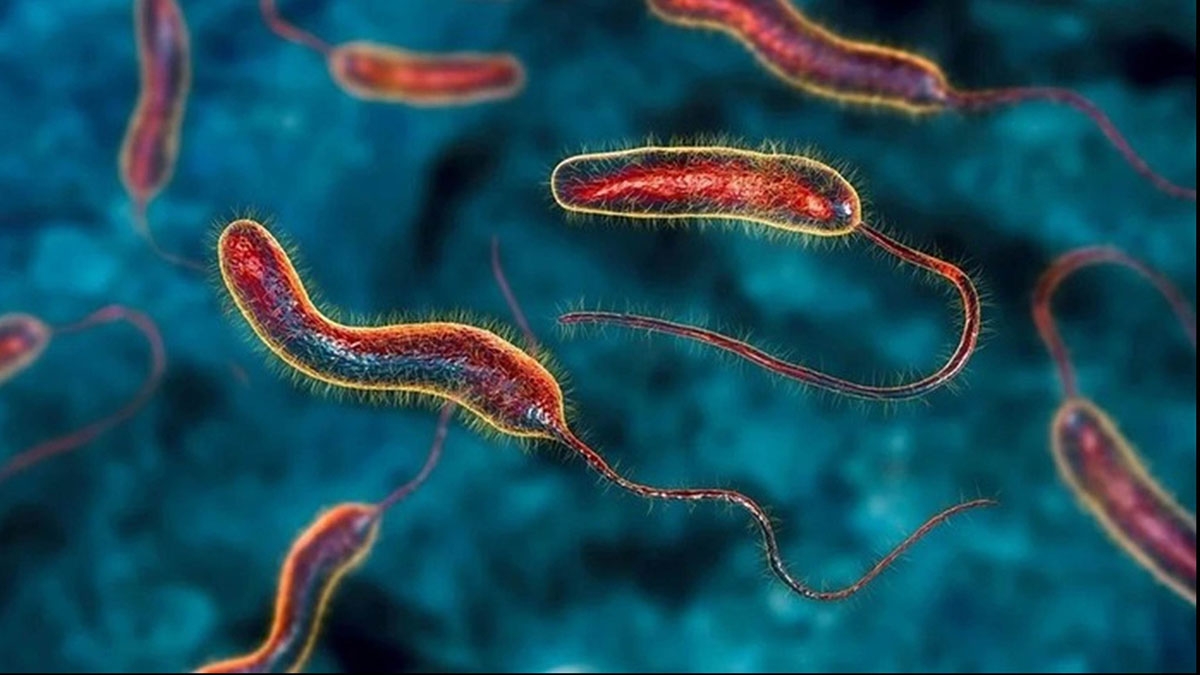 Vi khuẩn gây bệnh tả có tên khoa học là Vibrio cholerae. Ảnh: Internet