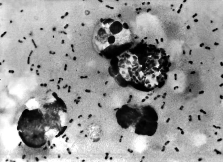 Vi khuẩn Yersinia pestis gây bệnh dịch hạch, trong đó phổ biến nhất là dịch hạch thể hạch, thường lây truyền qua vết cắn của bọ chét nhiễm bệnh - Ảnh: Trung tâm Kiểm soát và Phòng ngừa dịch bệnh Mỹ


