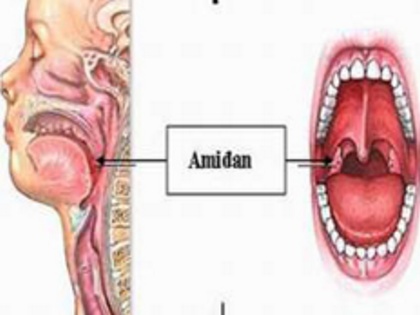 Hình ảnh amidan.