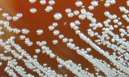 Vi khuẩn burkholderia pseudomallei gây ra bệnh melioidosis. Ảnh: CNN.