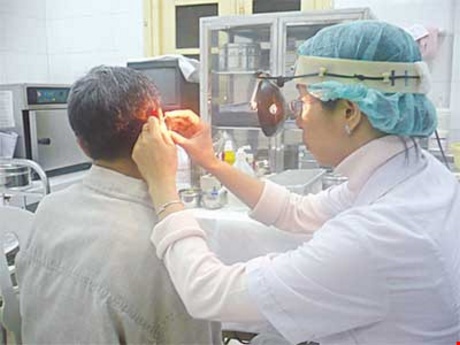  Nếu bị côn trùng chui vào tai mà có hiện tượng bất thường như đau, chảy máu, bạn nên sớm tới gặp bác sĩ để được xử lý đúng cách. Hình minh họa