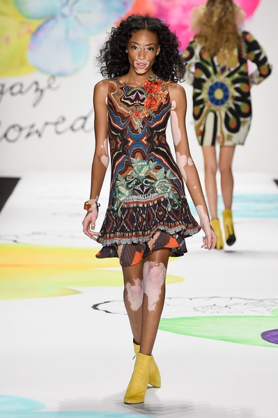 Winnie Harlow hiện tại rất đắt show quảng cáo và trình diễn thời trang. Winnie tiết lộ khi còn đi học, cô khổ sở vì làn da 