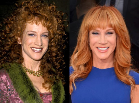 Không ưng ý với khuôn mặt của mình, Kathy Griffin đã đi chỉnh mũi từ năm 26 tuổi. Sau đó cô chỉnh răng, xăm mày... Thay đổi lớn nhất là đi hút mỡ khiến từ đó trở đi, cô trở thành người gày guộc. Tuy nhiên, nữ diễn viên khẳng định rằng cô không bao giờ hối tiếc đã đi thẩm mỹ để có được dung nhan theo mong muốn của mình.