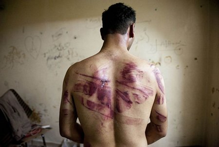 Một nạn nhân được cho là bị quân đội Syria tra tấn (Nguồn: AFP)