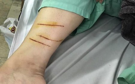 Trúc bị thương tích rất nhiều sau trận ẩu đả tại quán trà sữa vào đêm 30/3