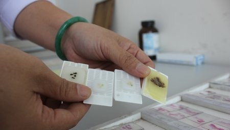 Cận cảnh một mẫu mô dạ dày trong đề tài đang thực nghiệm