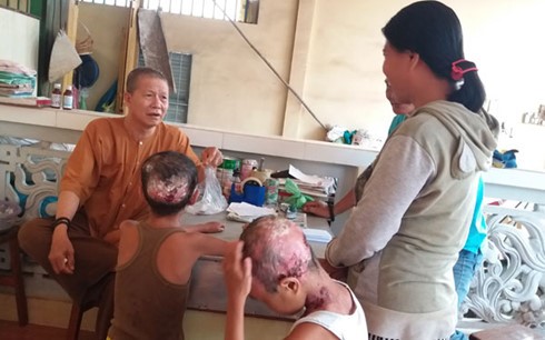 Các nhà hảo tâm thăm, tặng quà cho 2 em bị 