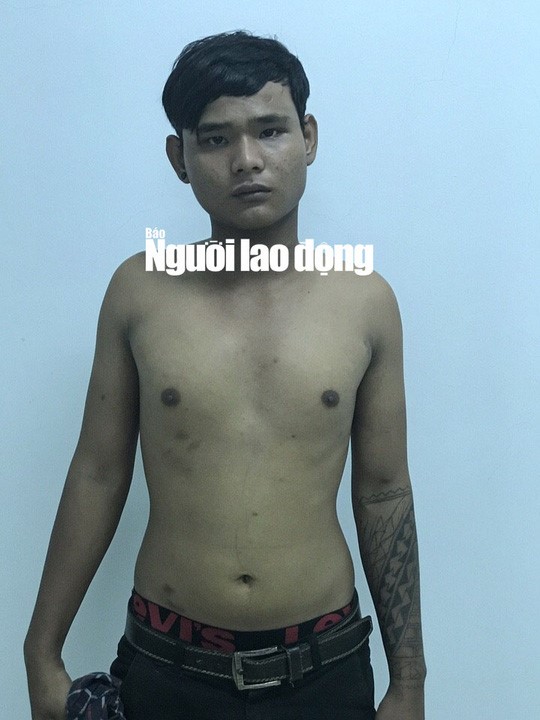 Bị can Huỳnh Quốc Dũng