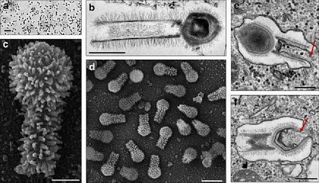 Hình ảnh phóng đại ở các kích thước khác nhau của Tupanvirus.