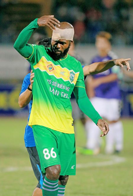 Hoàng Visai (86, XSKT Cần Thơ,) bị thương ở đầu trong trận gặp gặp Hà Nội FC tại vòng 2 của Giải bóng đá VĐQG Nuti Café V-League 2018 và như thế được bảo hiểm chi trả viện phí.