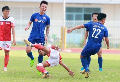  Trong tình huống tranh chấp bóng bổng, Tiến Phát ngã chống tay xuống mặt đất và bị gãy ngón tay.