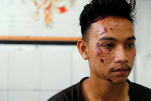 Một nạn nhân của sóng thần tại bệnh viện ở Pandeglang, tỉnh Banten, Indonesia.