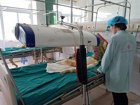 Các cháu bé bị bỏng nặng đang phải điều trị tích cực.