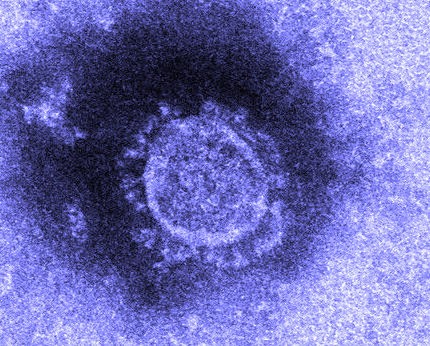 Nhật Bản đã cô lập thành công virus corona, mở đường cho việc tạo ra văcxin chống lại virus này - Ảnh: Jiji Press