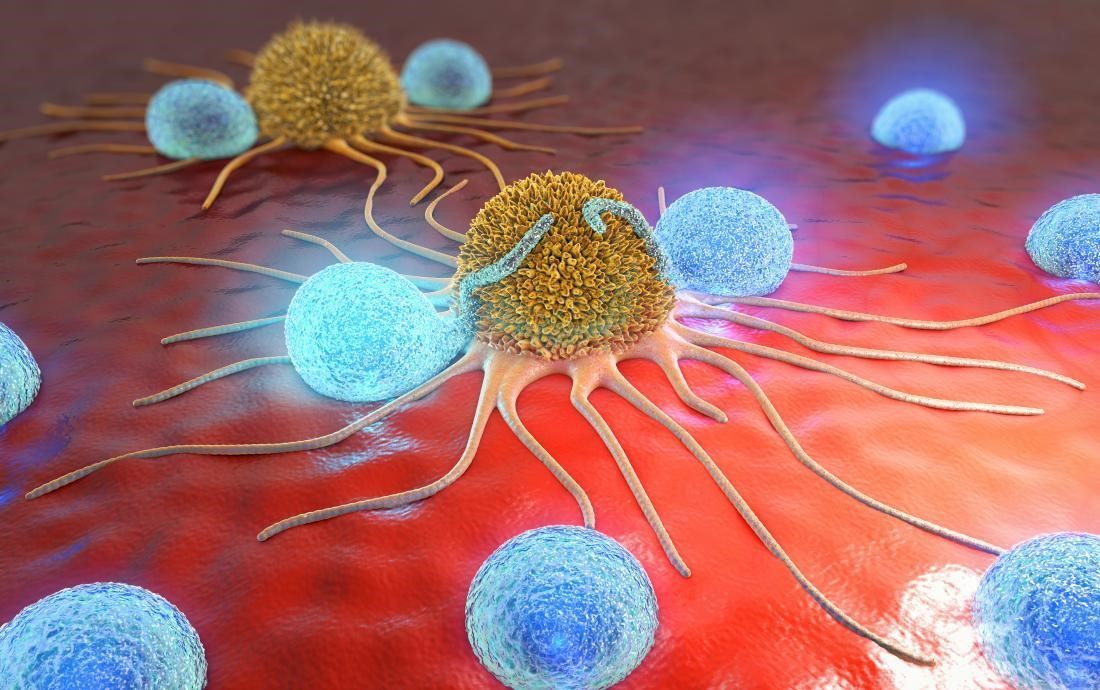 Tế bào ung thư. Ảnh: medicalnewstoday.com