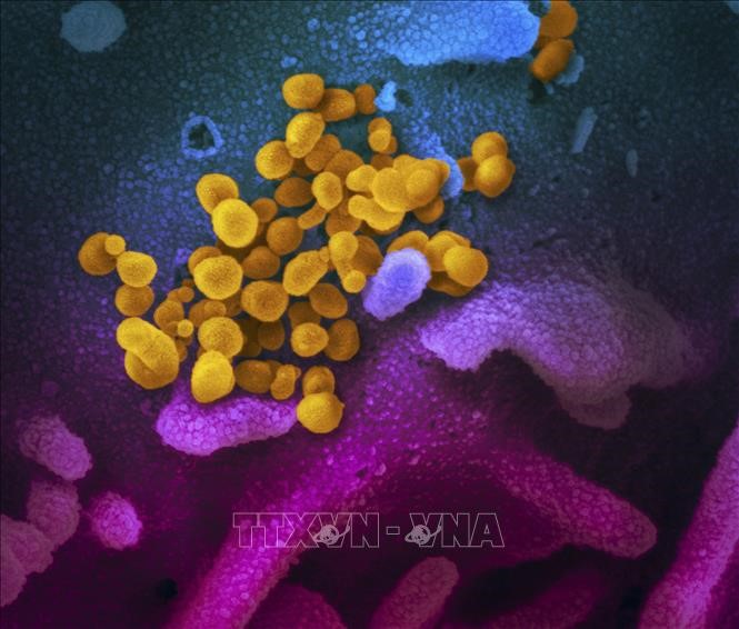 Hình ảnh do Viện nghiên cứu y tế quốc gia cung cấp cho thấy hình ảnh virus SARS-CoV-2 (màu vàng) gây dịch viêm đường hô hấp cấp COVID-19 nổi lên trên bề mặt tế bào (màu xanh, hồng) của một bệnh nhân COVID-19 ở Mỹ. Ảnh: AFP/TTXVN.