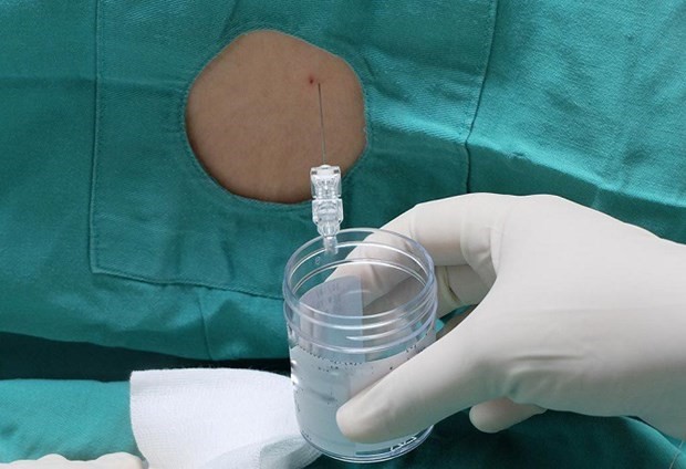 Các bác sỹ chọc dò dịch não tủy làm xét nghiệm đánh giá tình trạng viêm não màng não bệnh nhân.