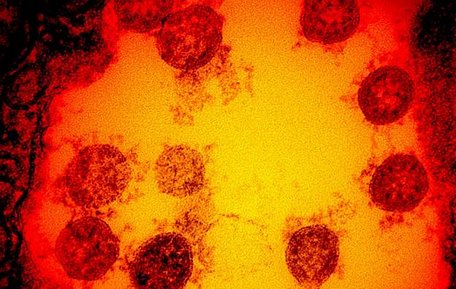 Ảnh chụp qua kính hiển vi điện tử về virus SARS-CoV-2. Ảnh: AFP